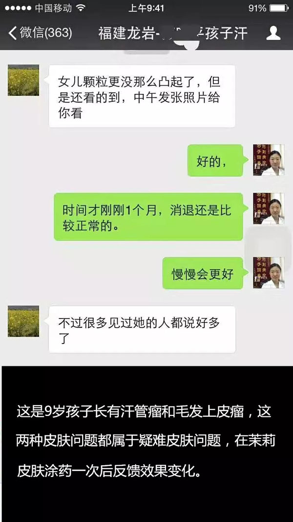 汗管瘤