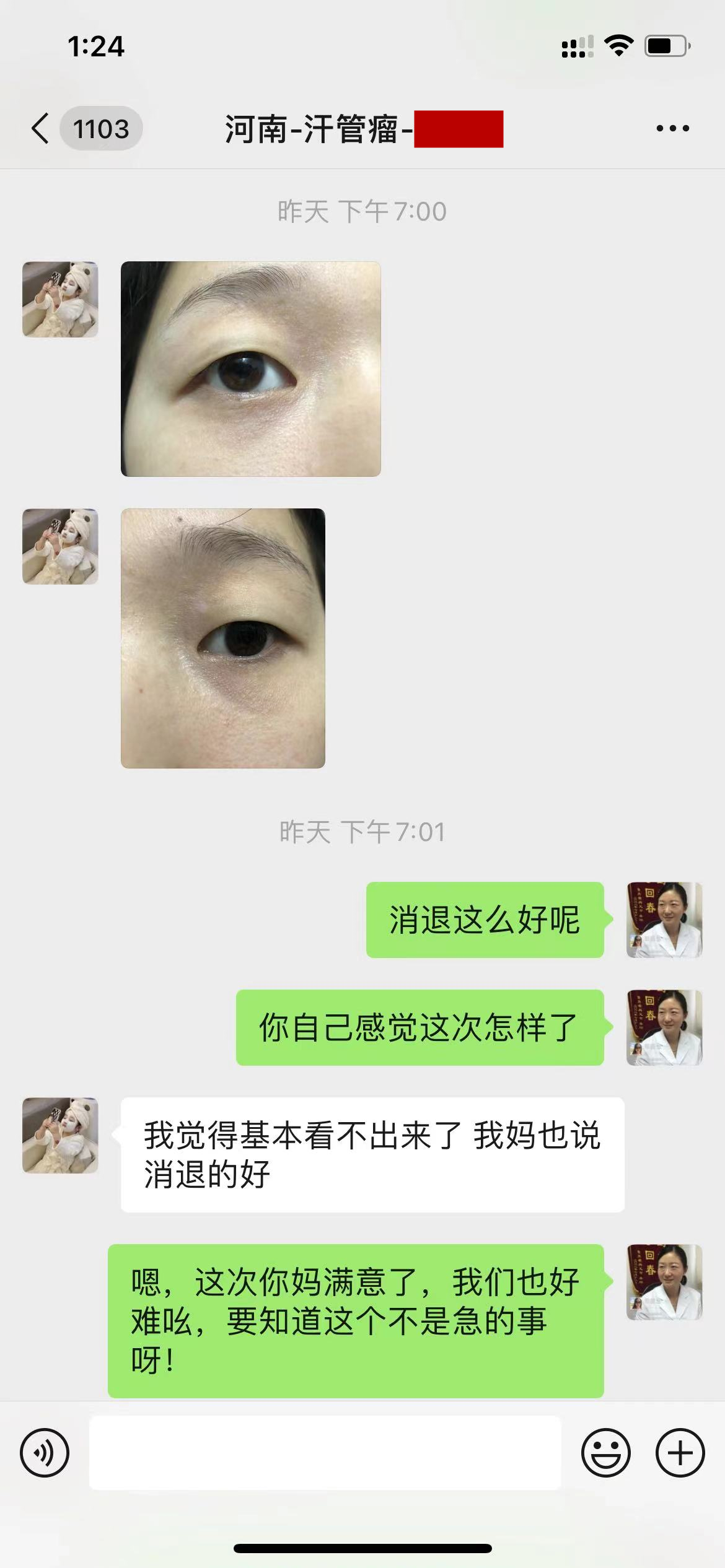 河南16岁女生脸上汗管瘤消退下去，幸好她没有听妈妈的话(图2)